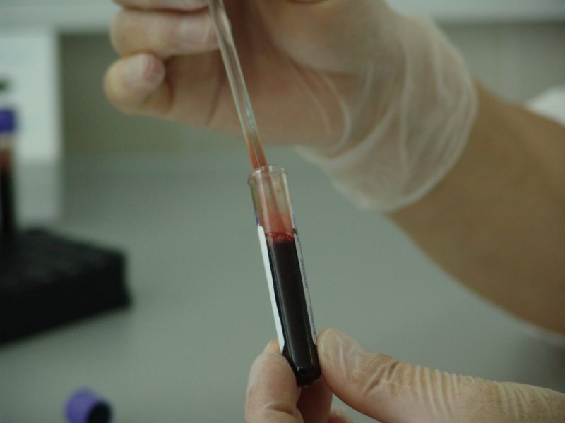 Quanto costa l'analisi del sangue in gravidanza senza assicurazione? Con 3 test utili!