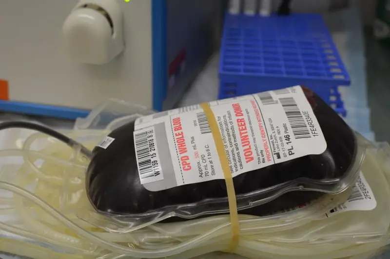 Che cos'è una donazione di sangue autologa? I suoi 3 metodi fantastici!
