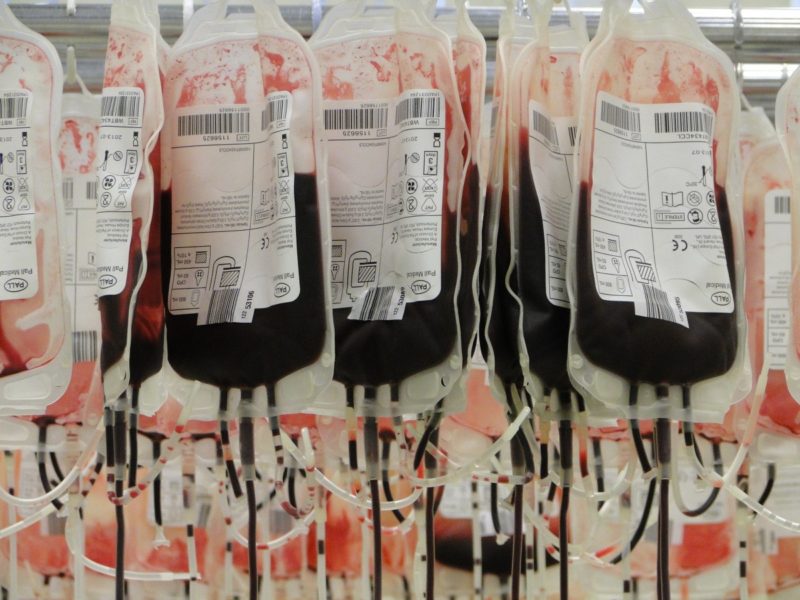 Che cos'è una donazione di sangue automatizzata? 4 fattori importanti per diventare un donatore di sangue!